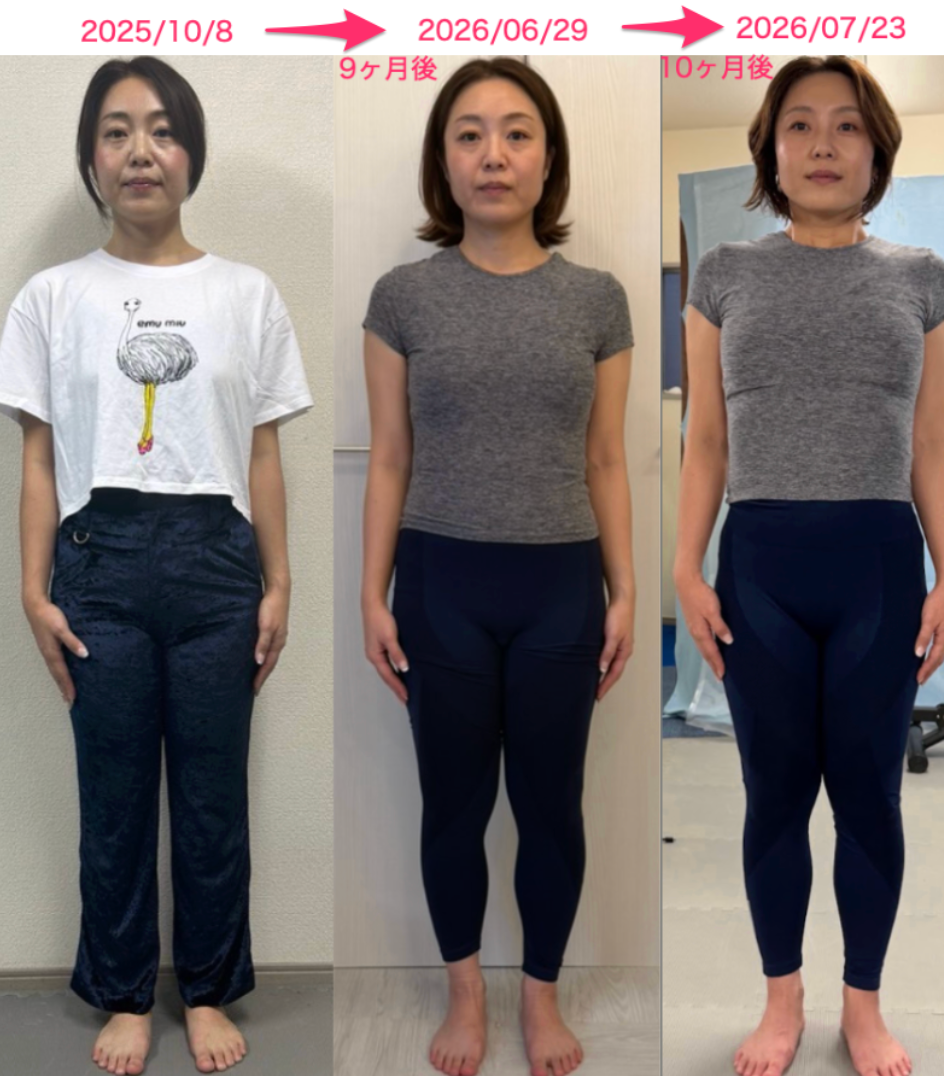 40代・経営者 Fさんの正面の変化